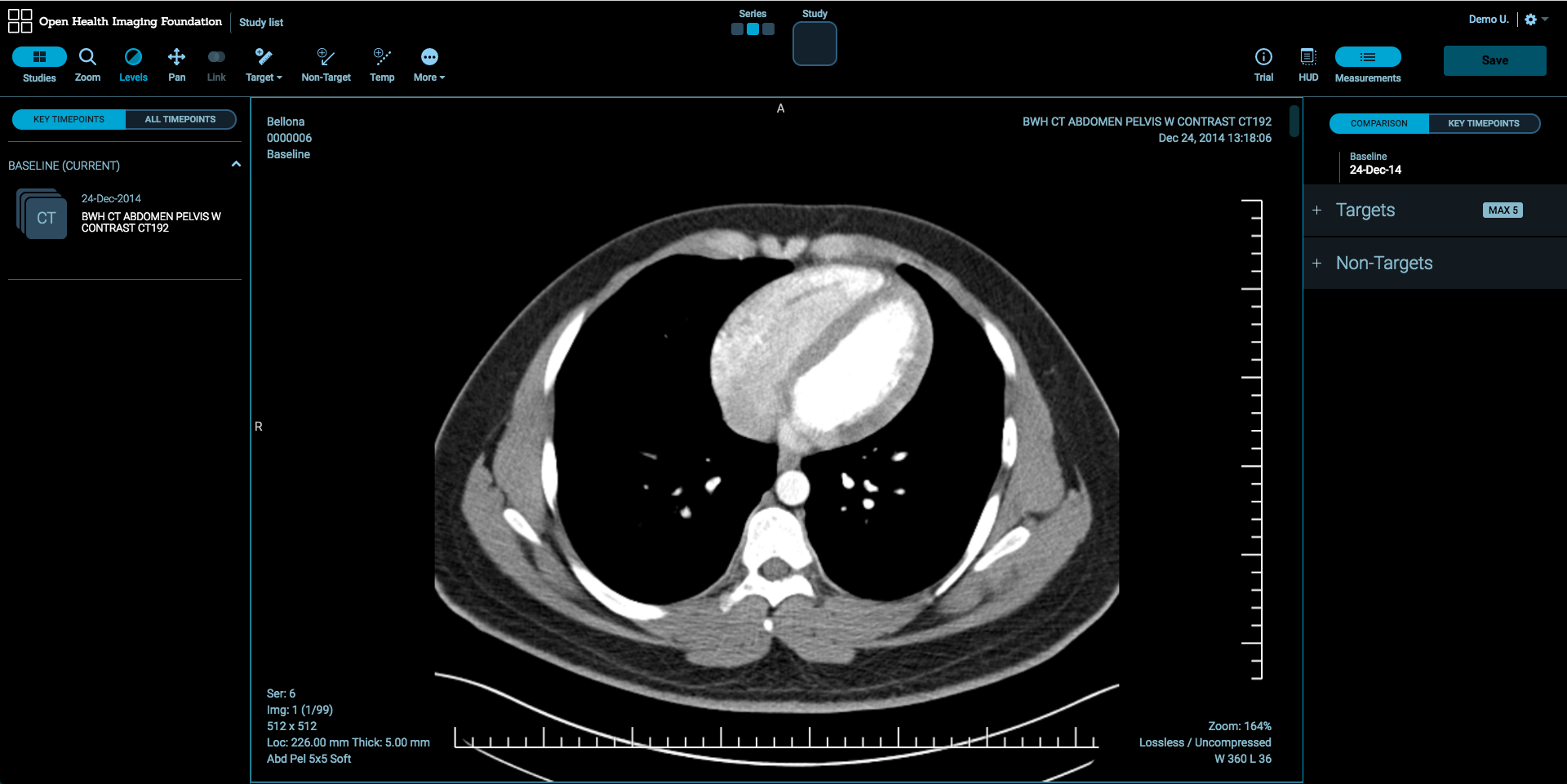 Lesion Tracker Screenshot